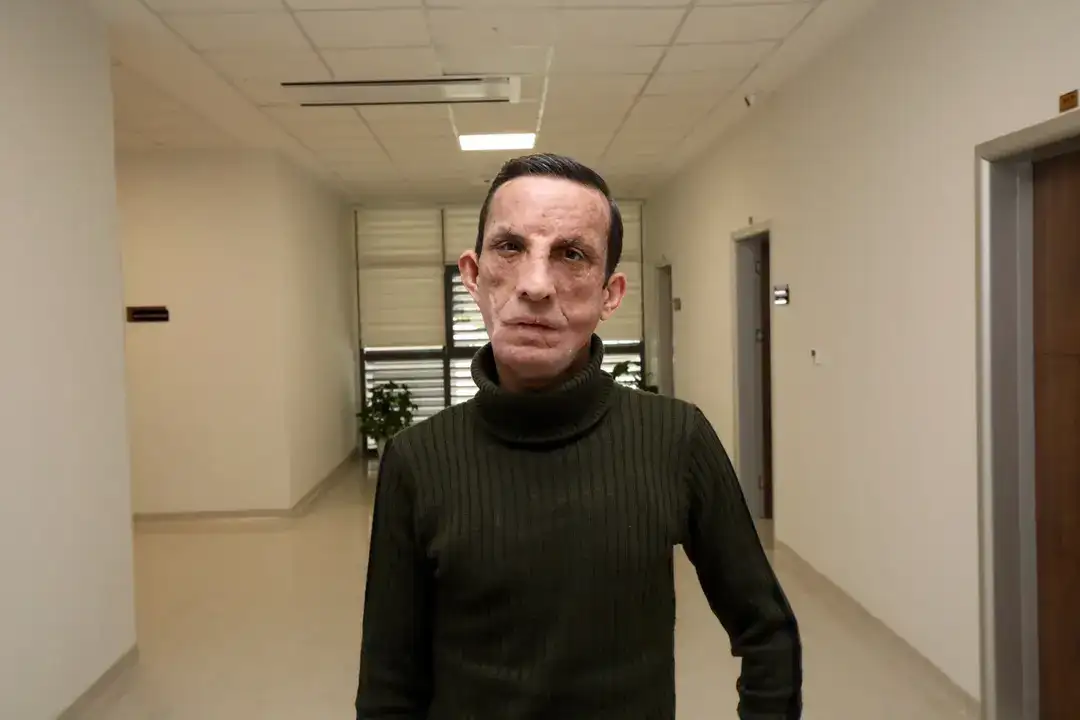 Manavgatlı Uğur Acar: 'Yüzünü Aldığım Kişinin Yaşındayım' 12